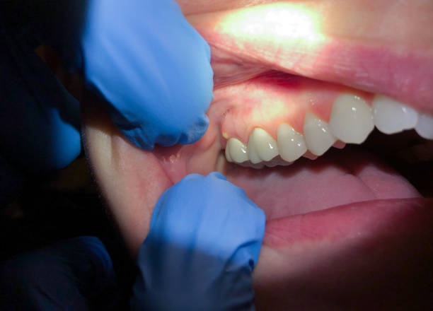 Best Emergency Broken Tooth Repair in Manteo, NC